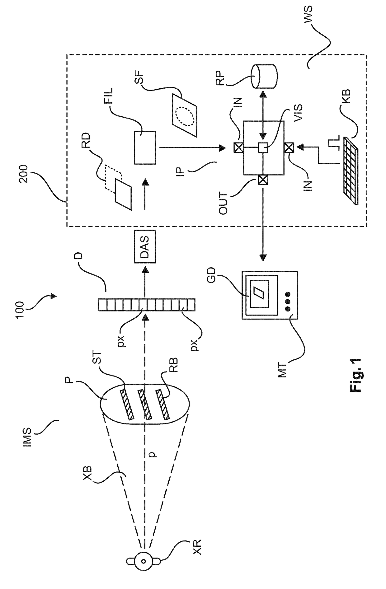 Silhouette display for visual assessment of calcified rib-cartilage joints