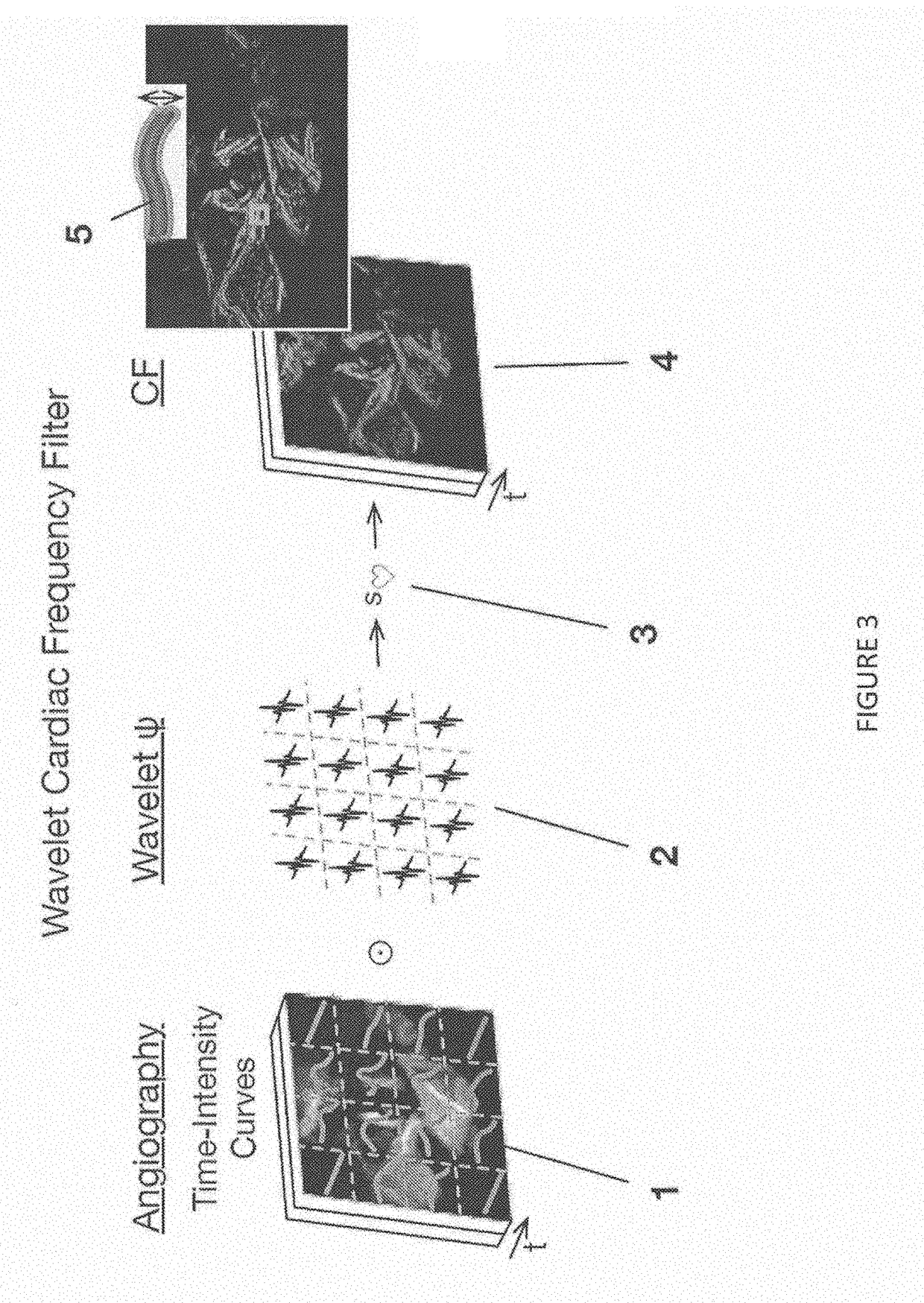 Device and method for spatiotemporal reconstruction of a moving vascular pulse wave in the brain and other organs