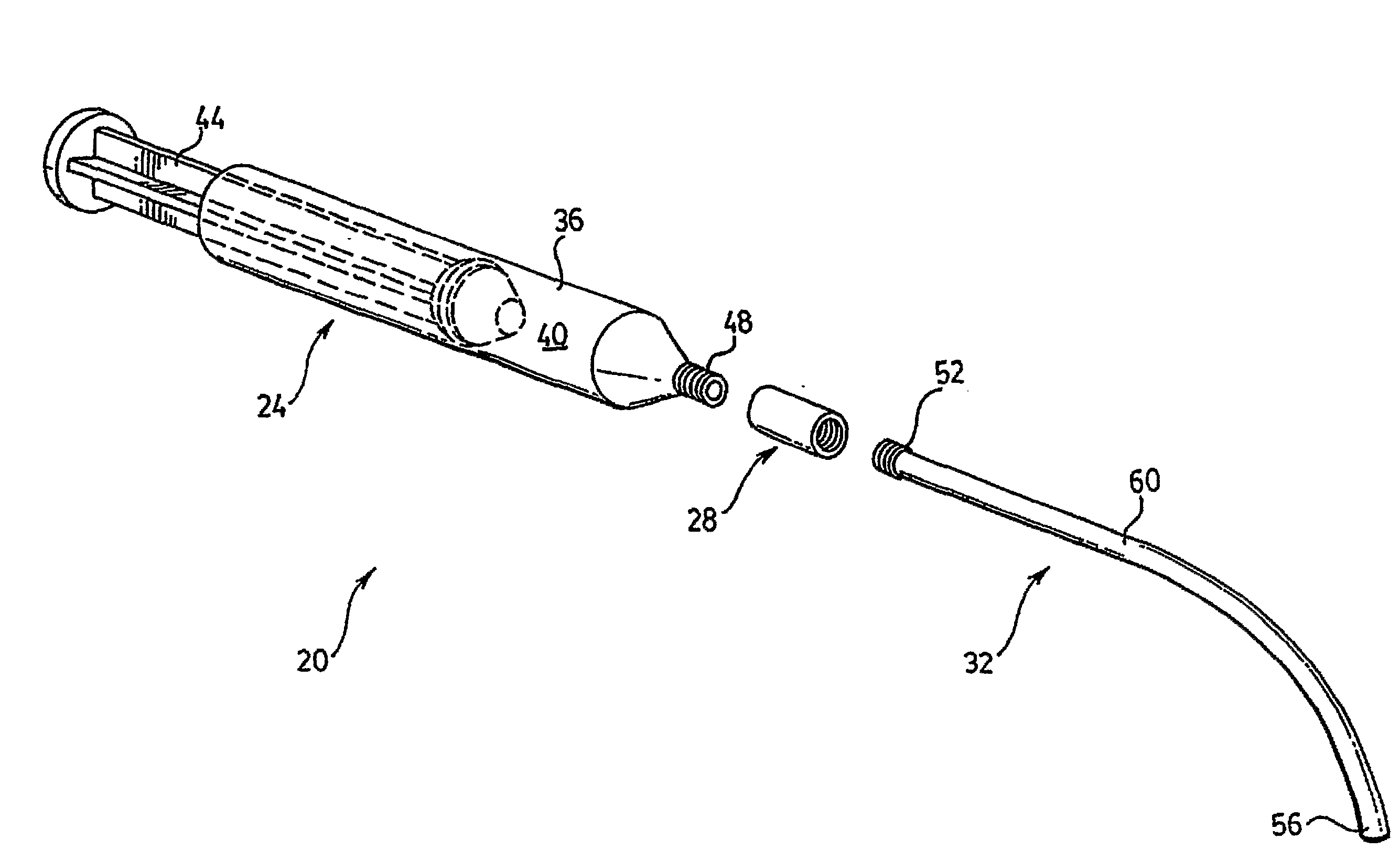 Bone Augmentation Apparatus