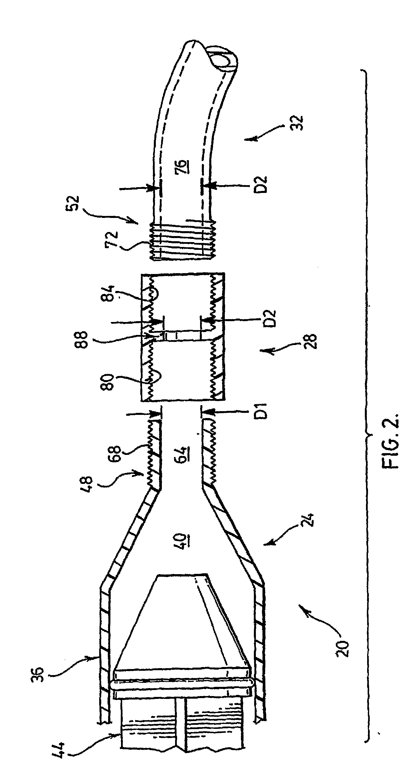 Bone Augmentation Apparatus