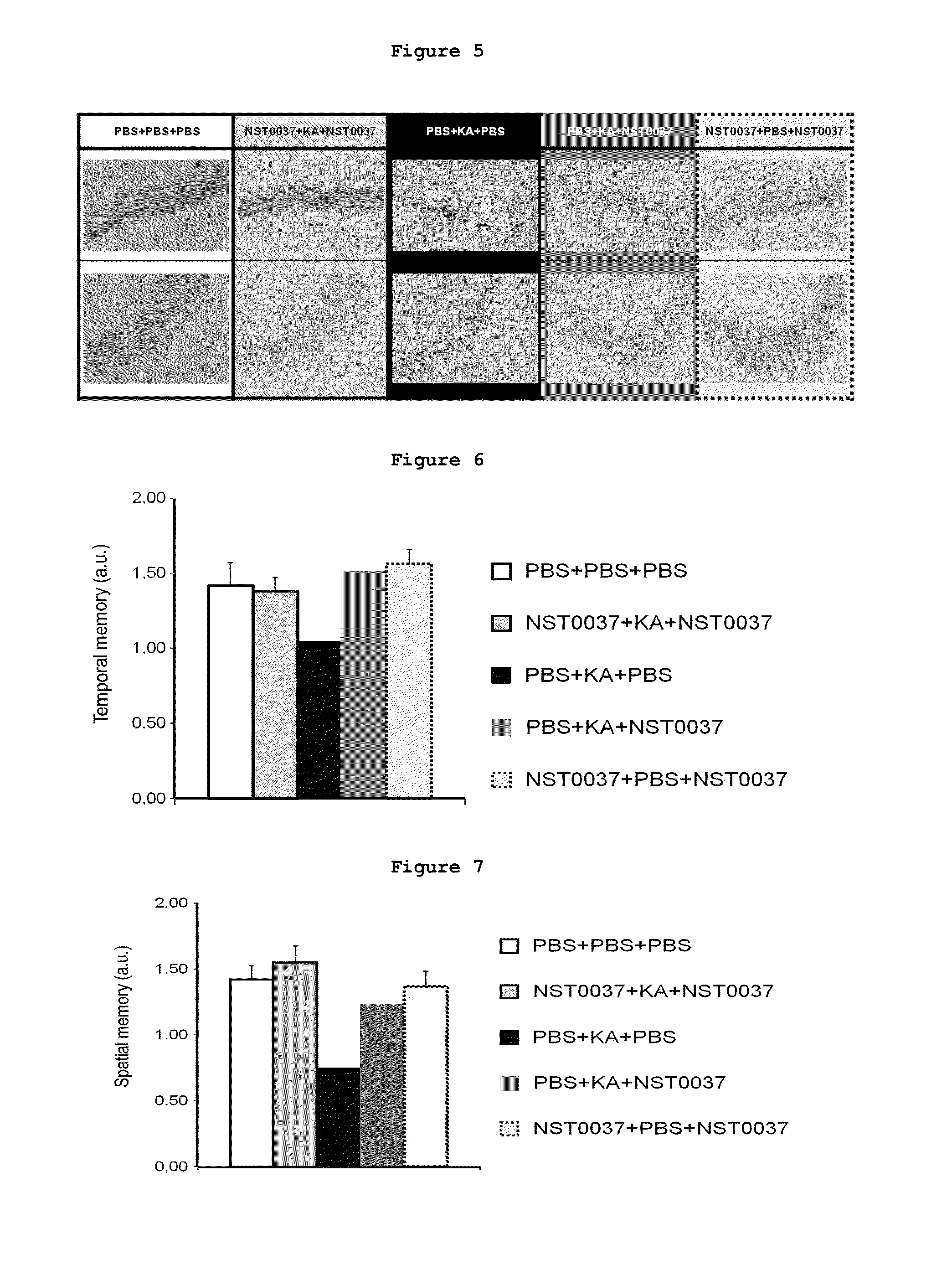 Antiepileptic, hypocholesterolemic and neuroprotective compound