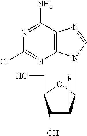 Methods and Compositions for the Treatment of Lupus Using Clofarabine