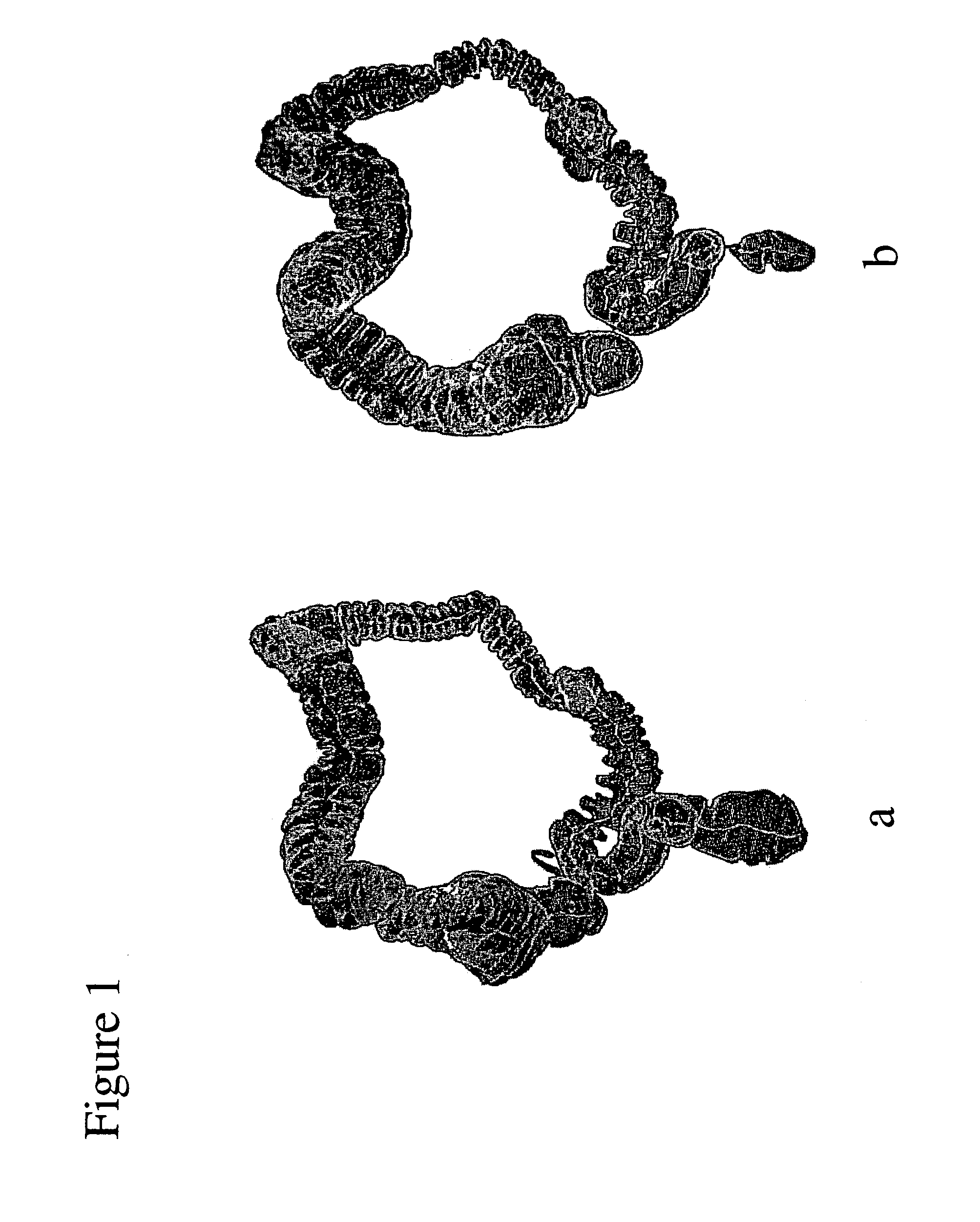 Method for matching and registering medical image data