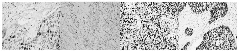 Immunohistochemical nuclear staining section cell positioning multi-domain co-adaptation training method