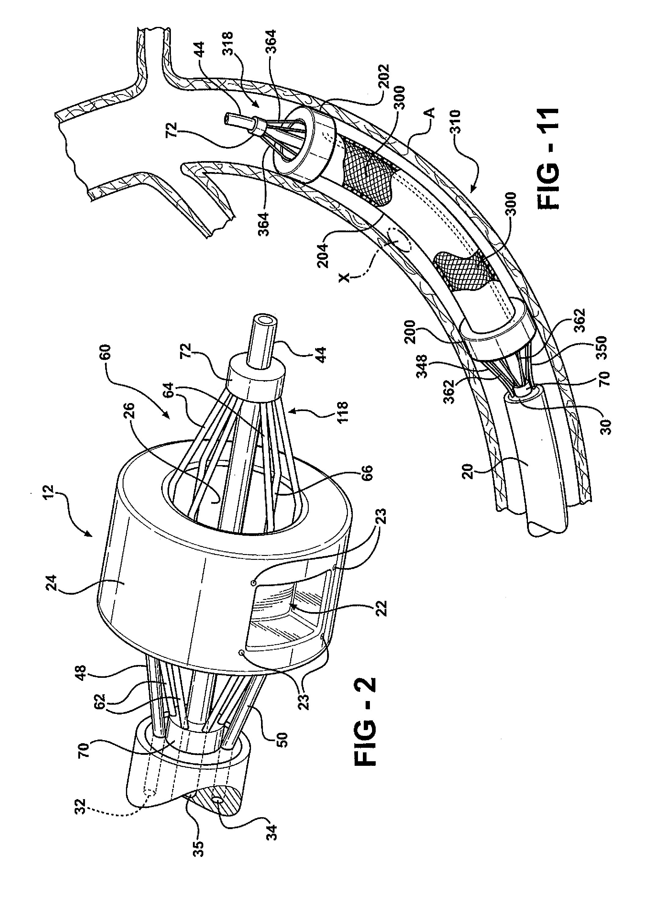 Clampless anastomotic device