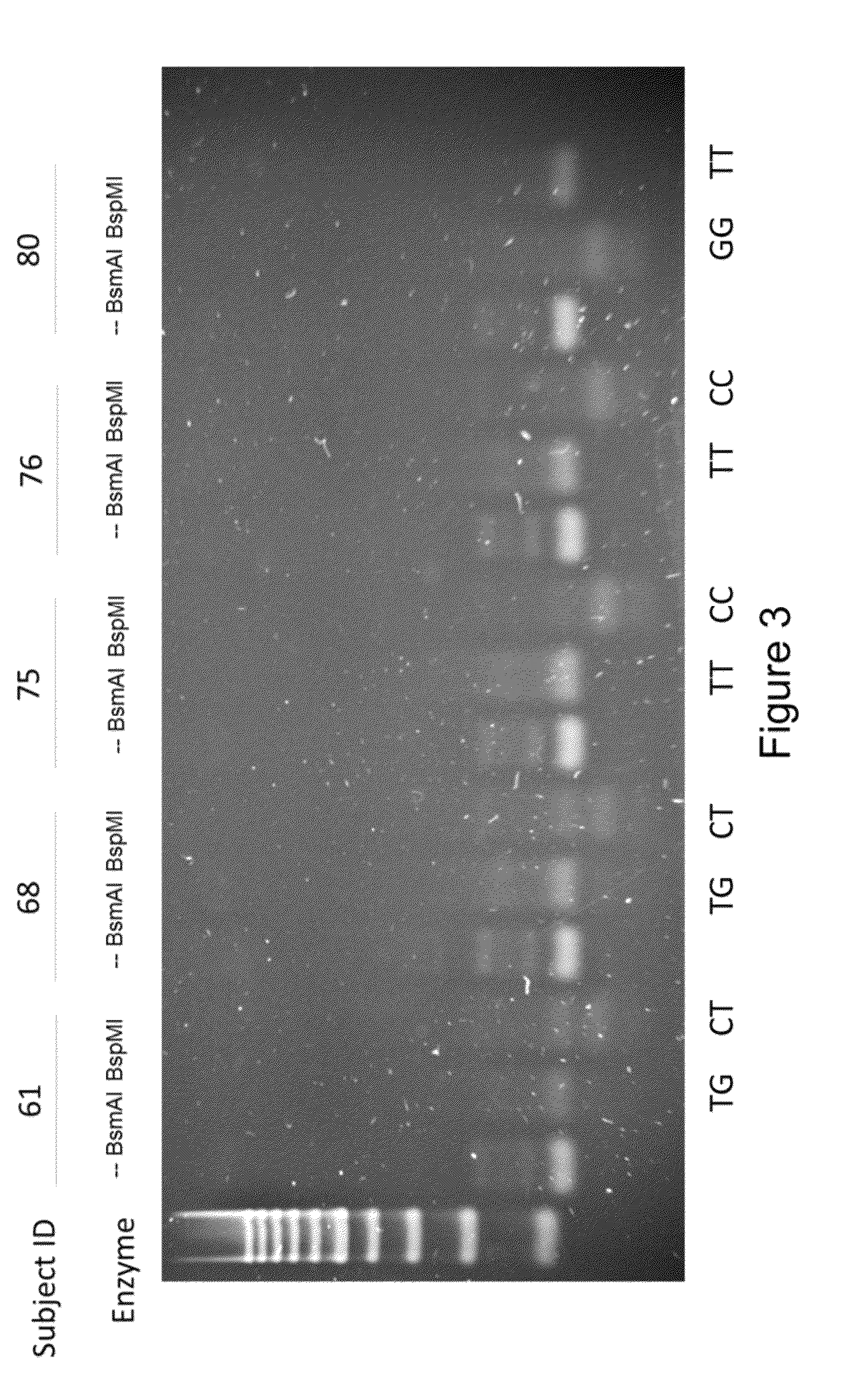 Methods and kits for predicting the responsiveness of hepatocellular carcinoma patients to 5-fluorouracil-based combination chemotherapy