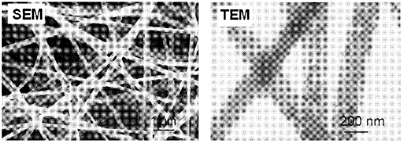 Calcium phosphate-collagen nanometer fiber compound nanometer artificial bone and preparation method thereof