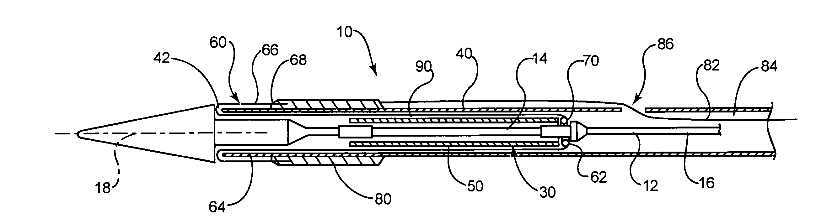 Stent delivery system