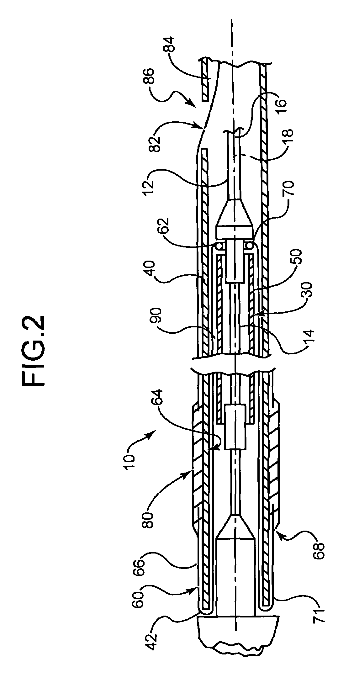 Stent delivery system