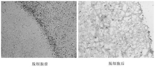 Single-layer or multi-layer 3D brain glioma cell culture model, and construction method and application thereof