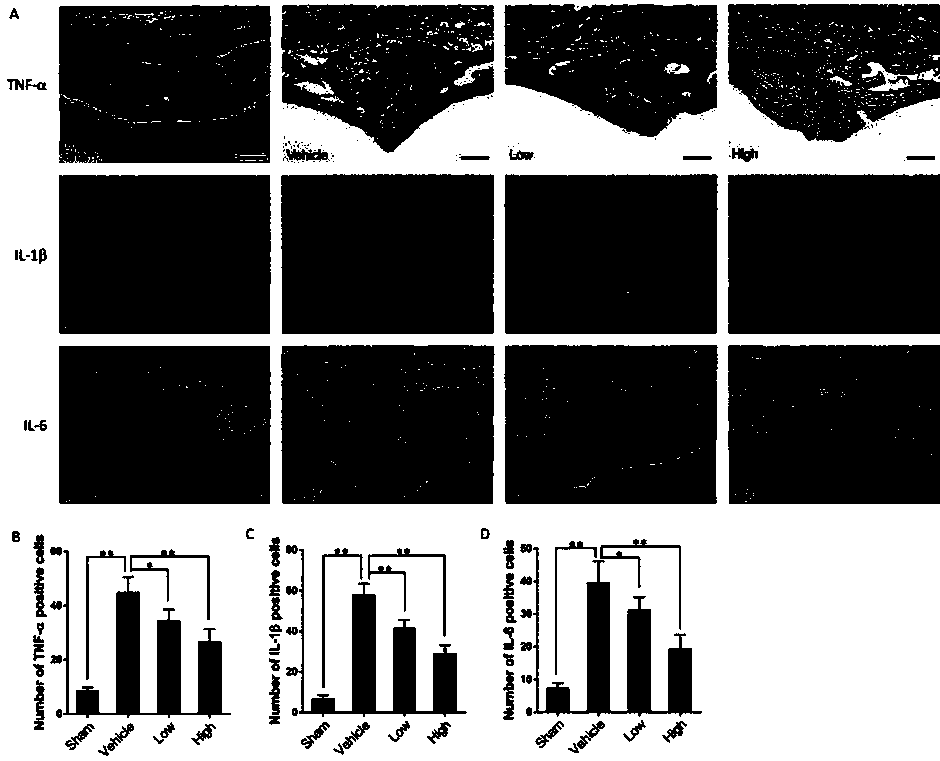 Use of melatonin in the preparation of medicines for treating chronic inflammation and bone destruction around loose prostheses