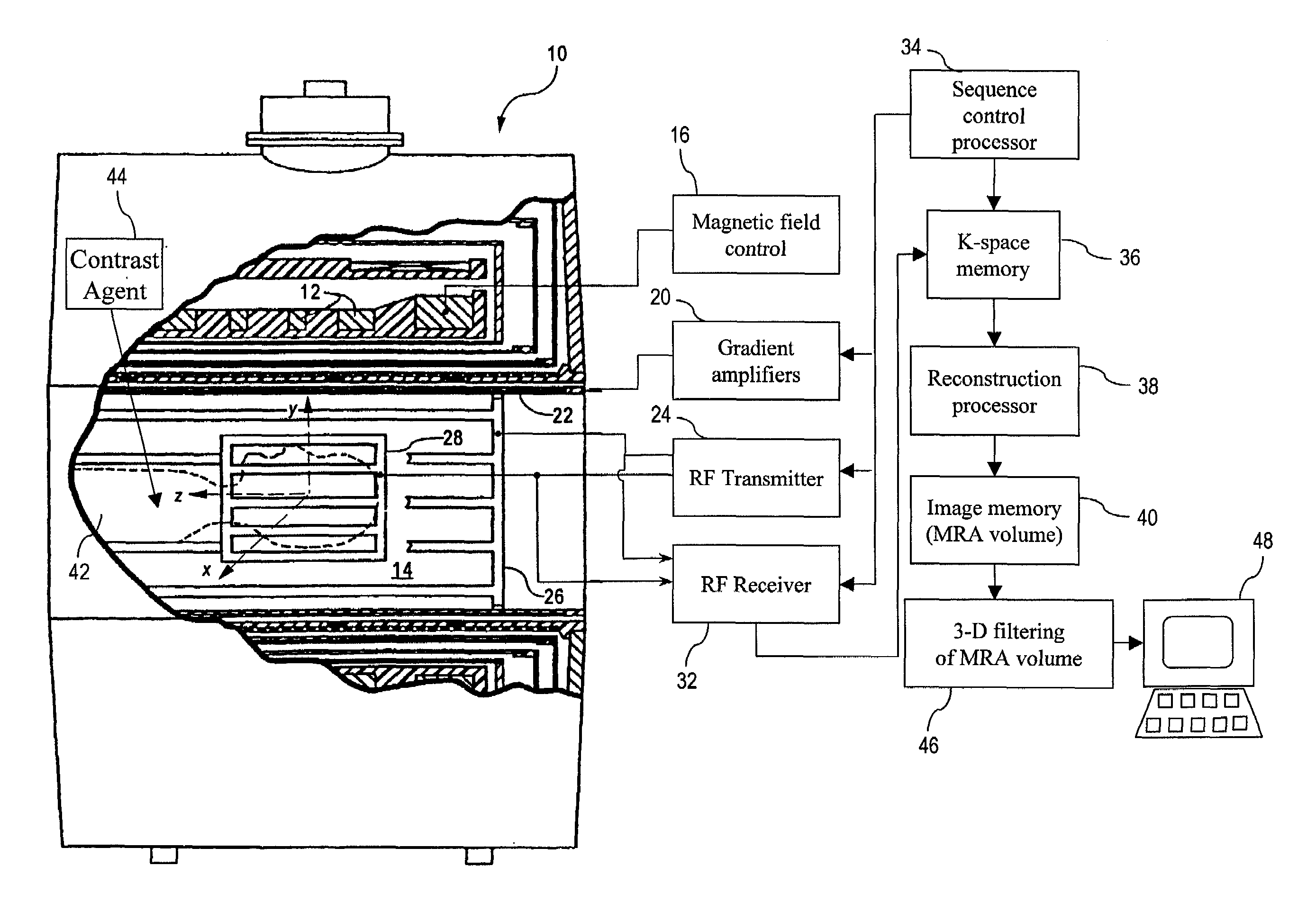 Method and apparatus for three-dimensional filtering of angiographic volume data