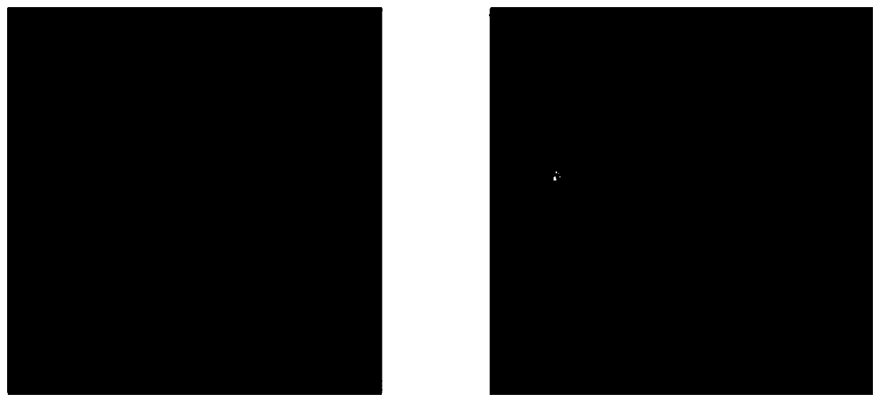 FCM-based diabetic retina image optic disk segmentation method