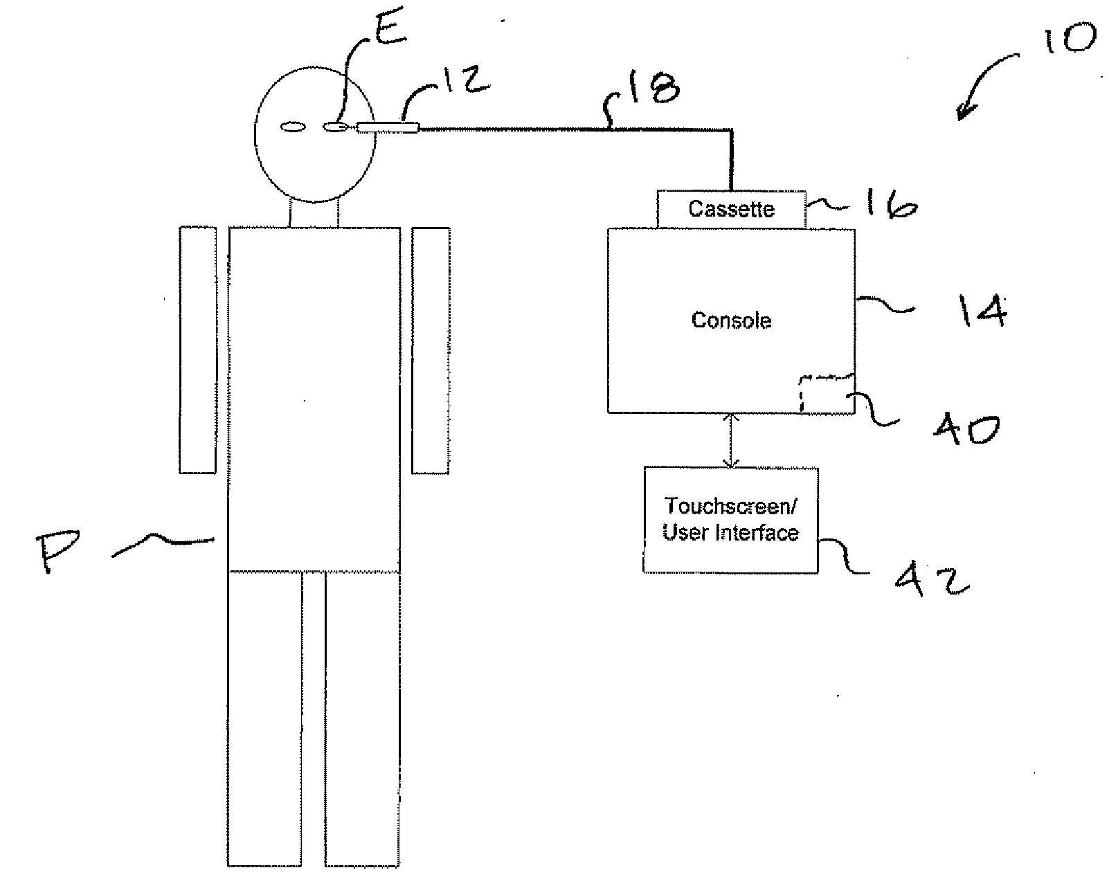 Critical alignment of fluidics cassetts