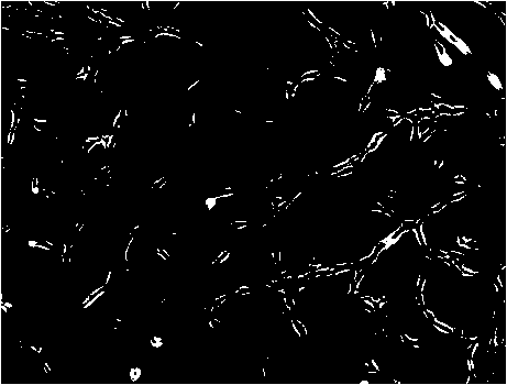 Lymphatic endothelial cell culture medium, and preparation method and application thereof