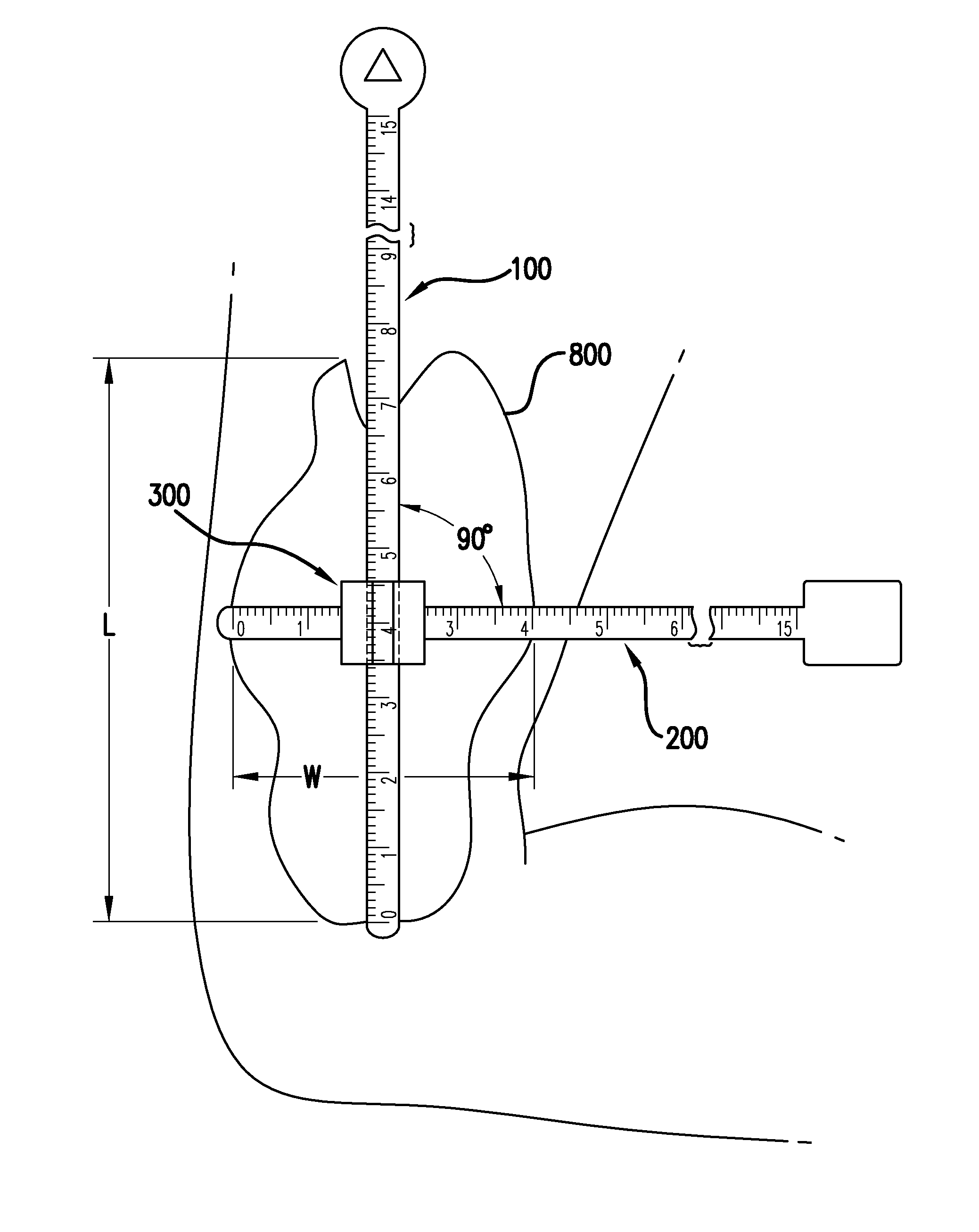 Wound Measuring Device and System