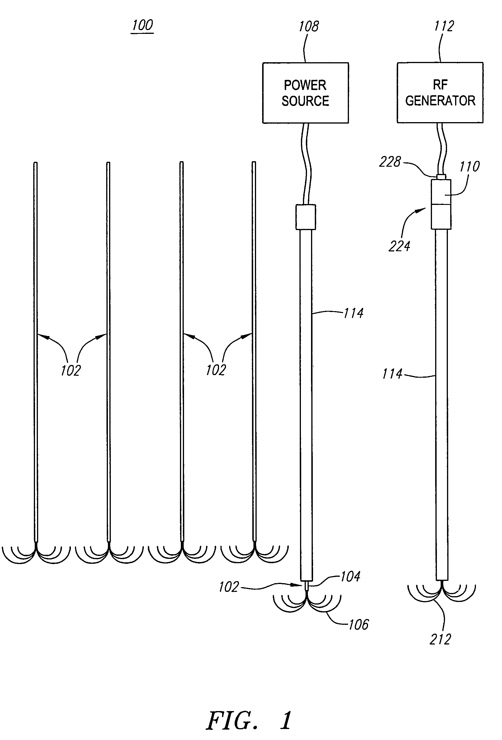 System for indirectly ablating tissue using implanted electrode devices