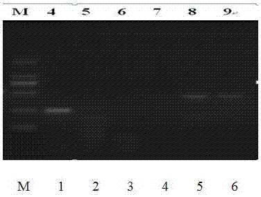 Primer and reagent kit of differentiating virulent and attenuated Newcastle disease viruses and differential detection method