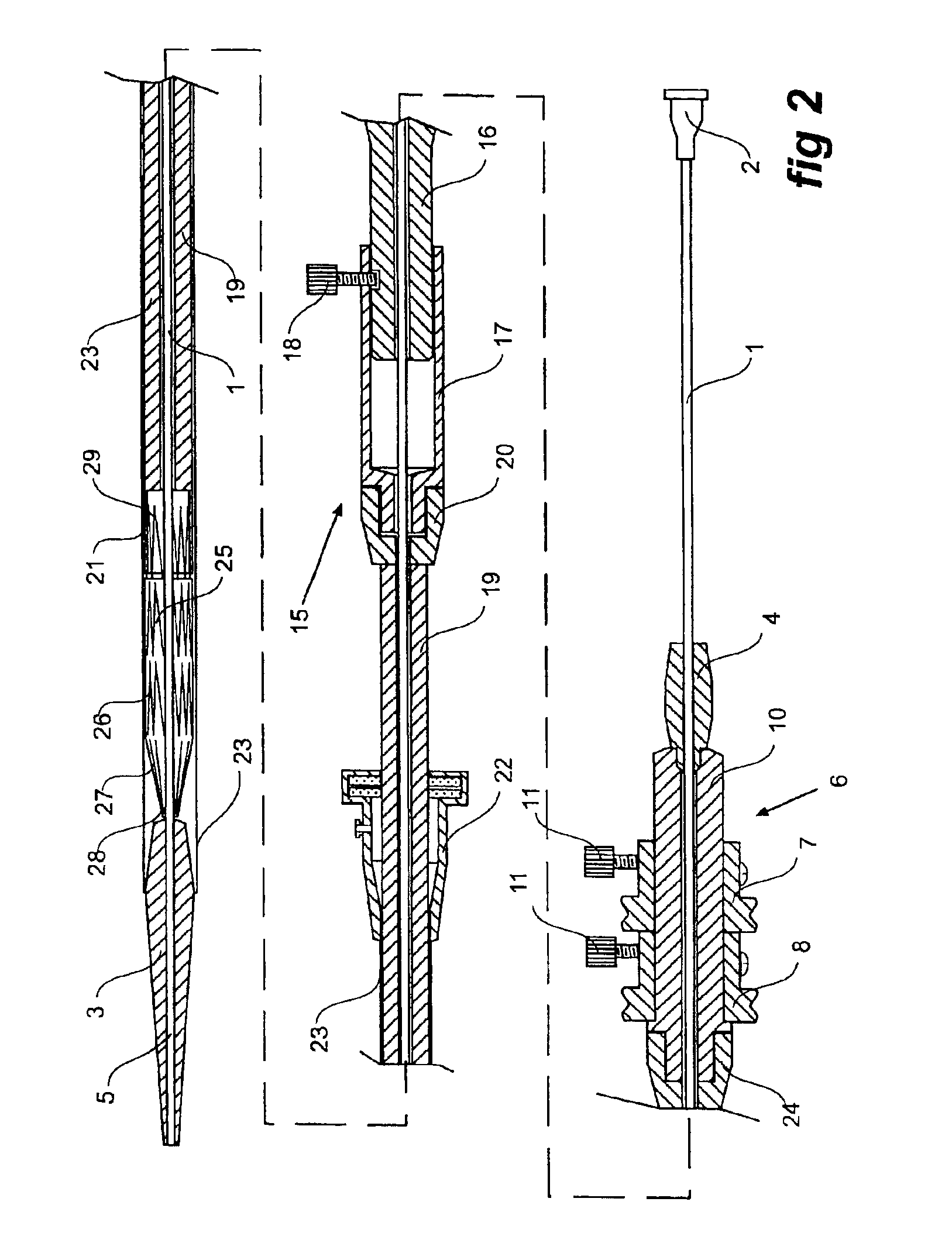 Thoracic aortic stent graft deployment device