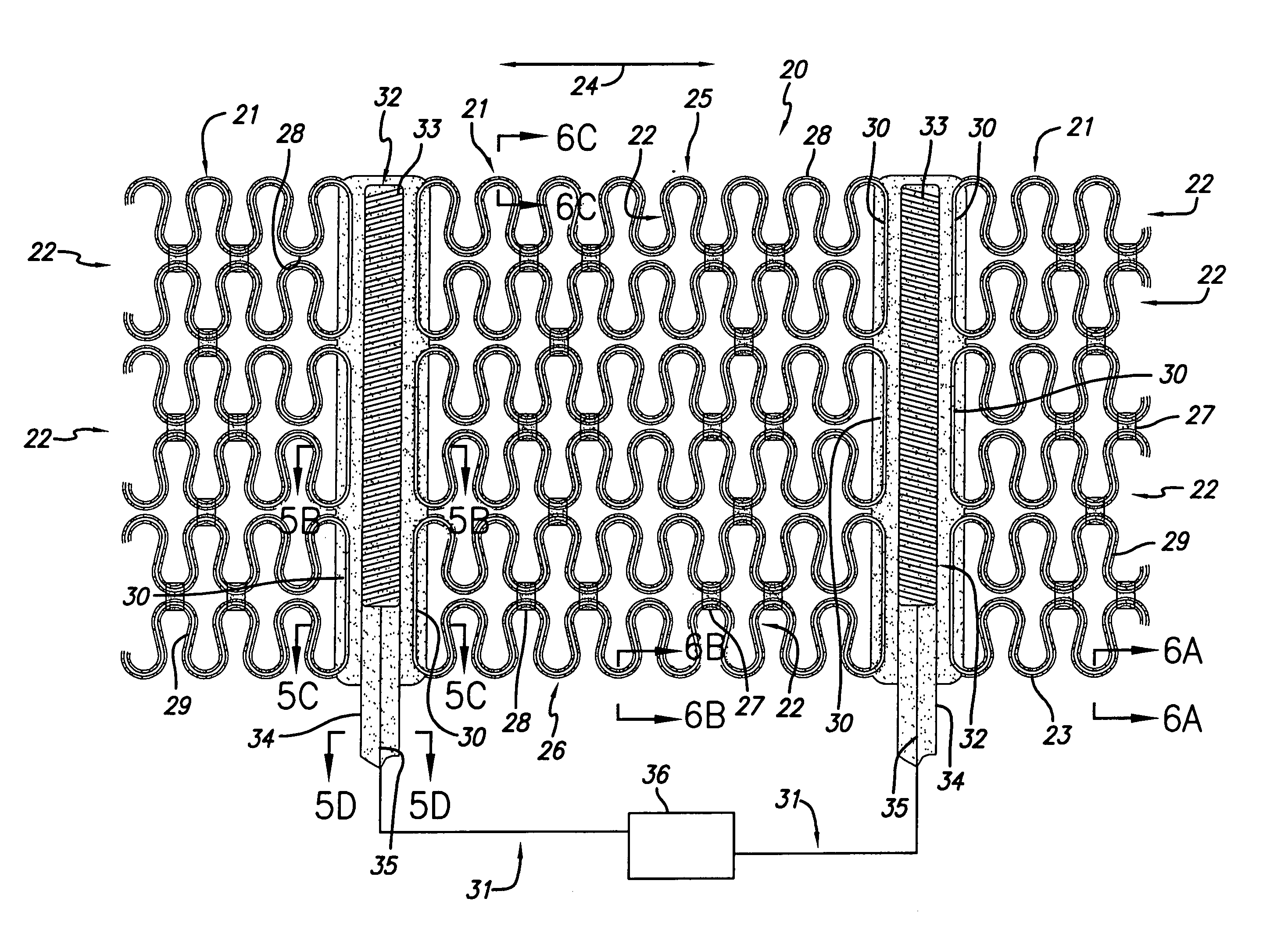 Cardiac harness having radiopaque coating and method of use