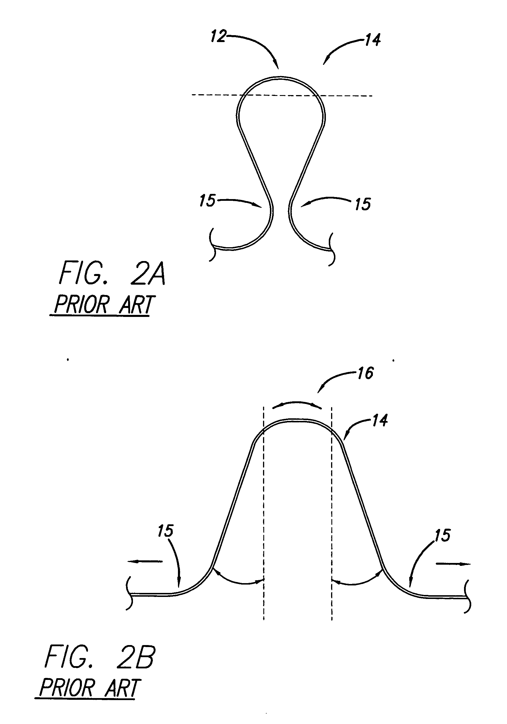 Cardiac harness having radiopaque coating and method of use