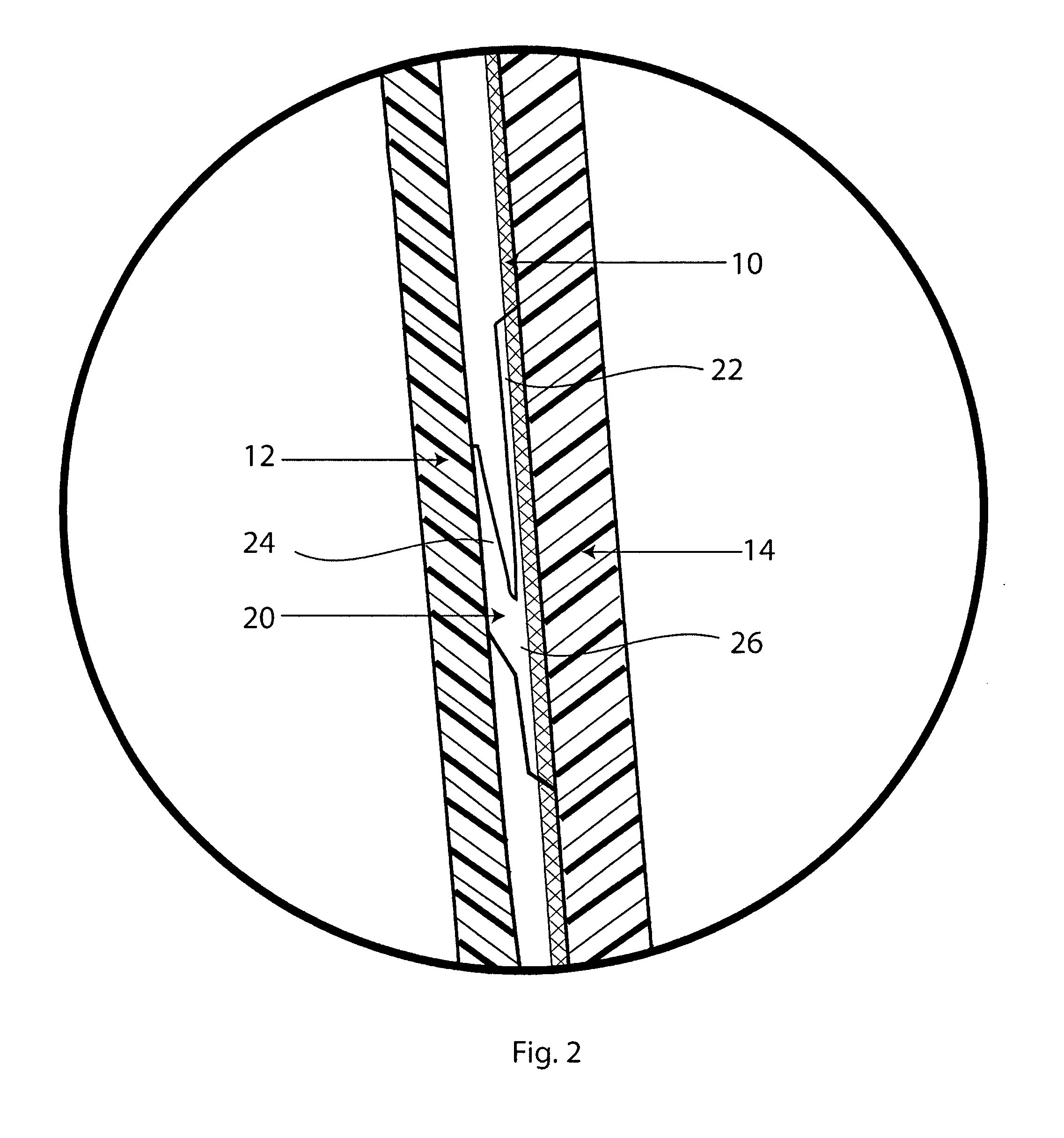 Sealing sheath for prosthetic liner and related methods