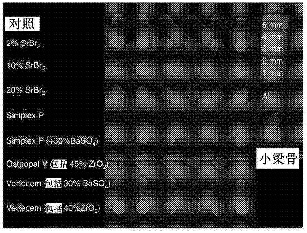 Compositions comprising injectable biomaterial cement and radiopacity-improving agent