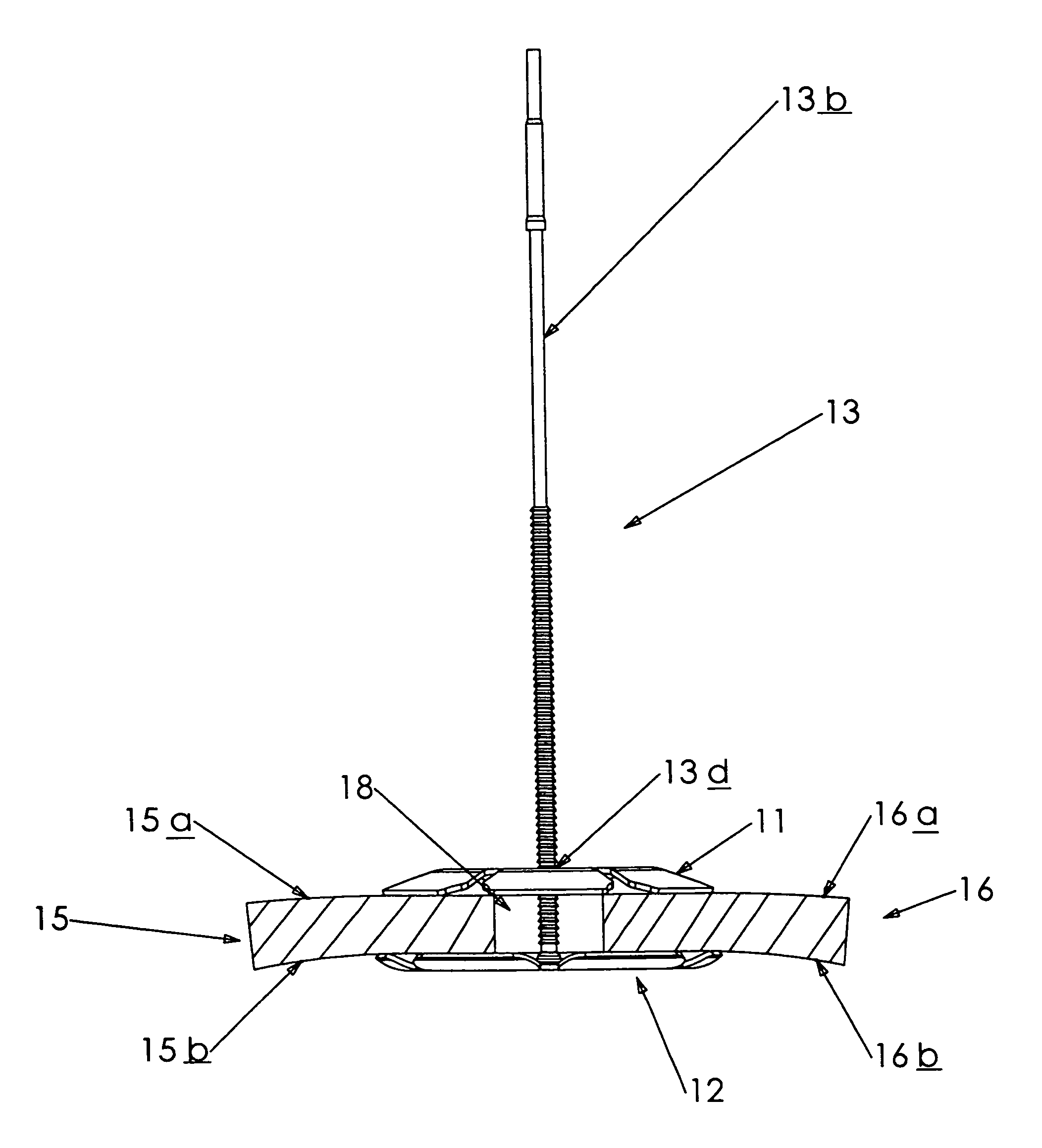 Cranial bone flap fixation system and method