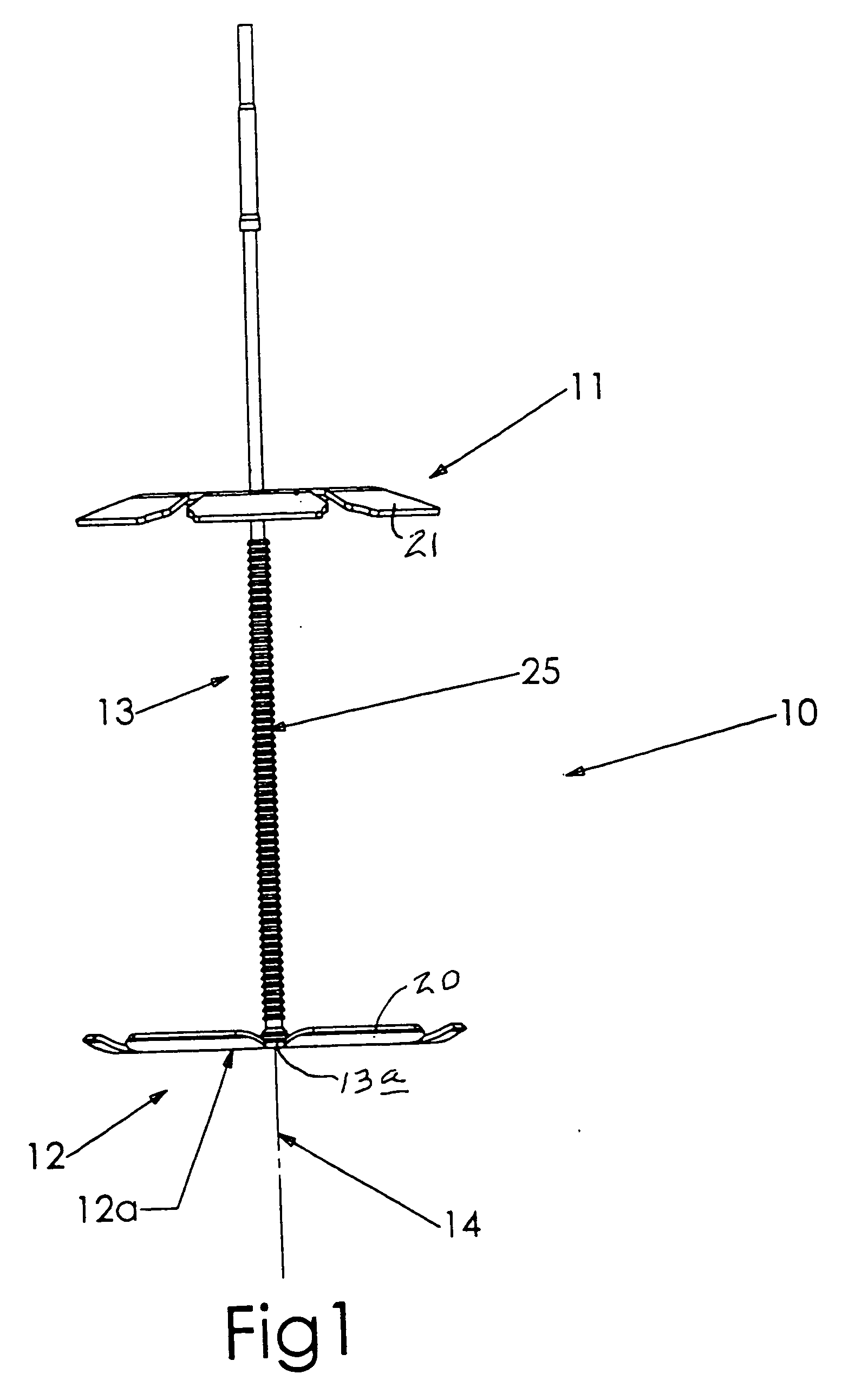 Cranial bone flap fixation system and method