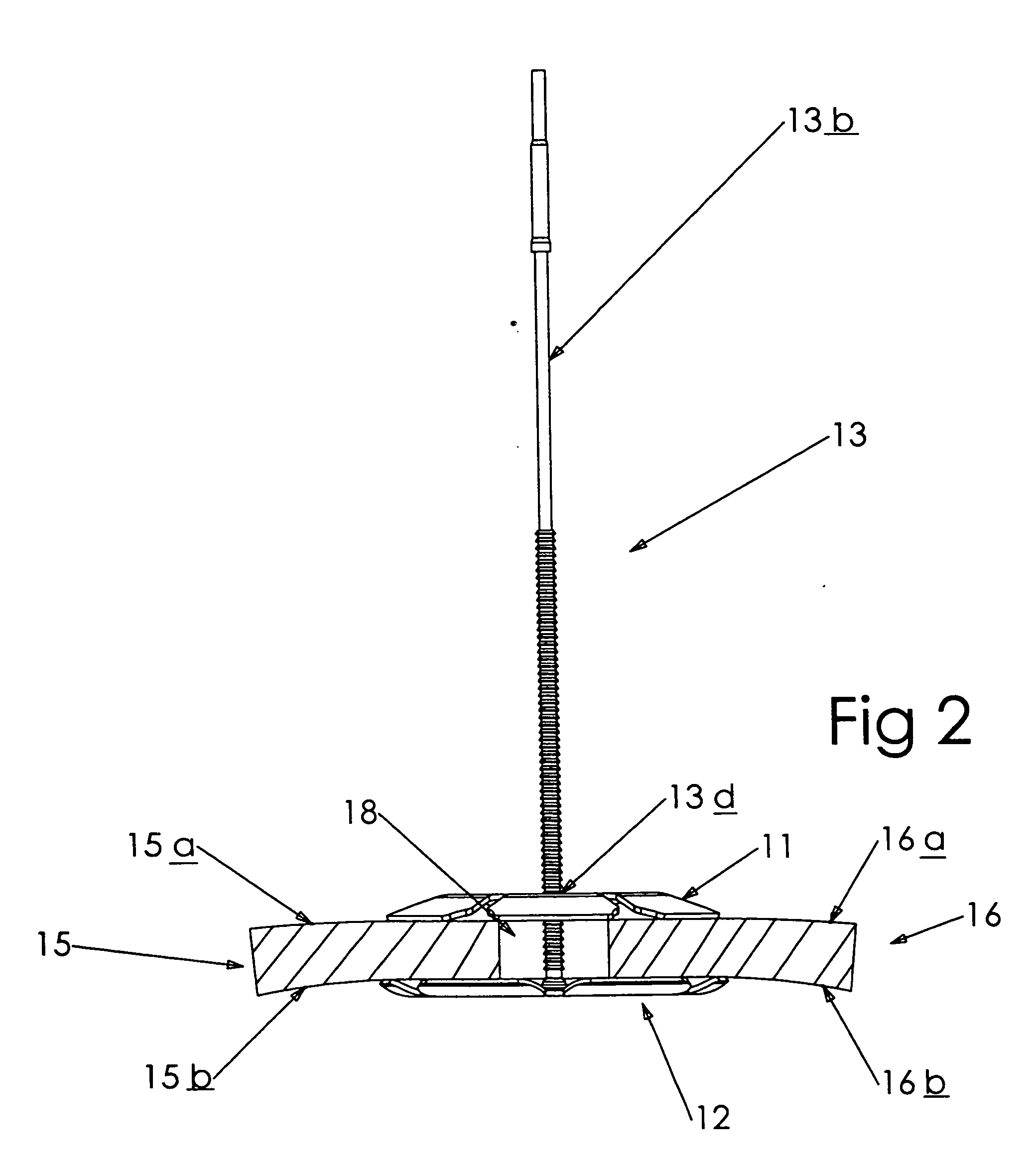 Cranial bone flap fixation system and method