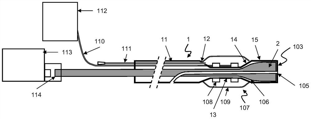 Catheter integrating laser ablation and vascular shock wave plasty