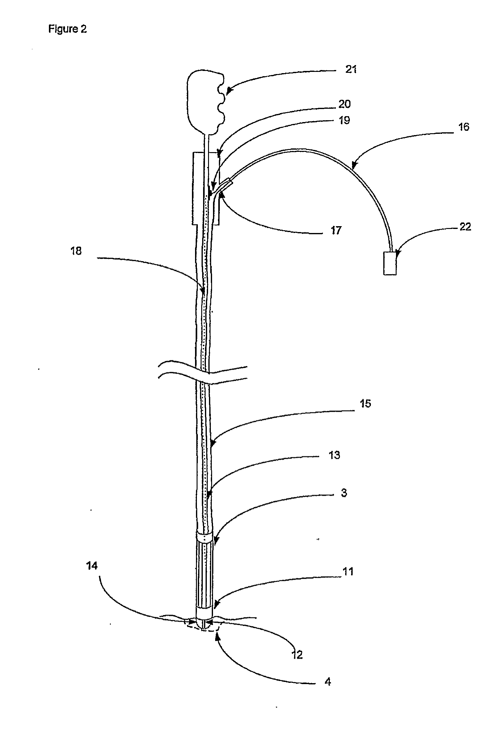 Tissue ablator