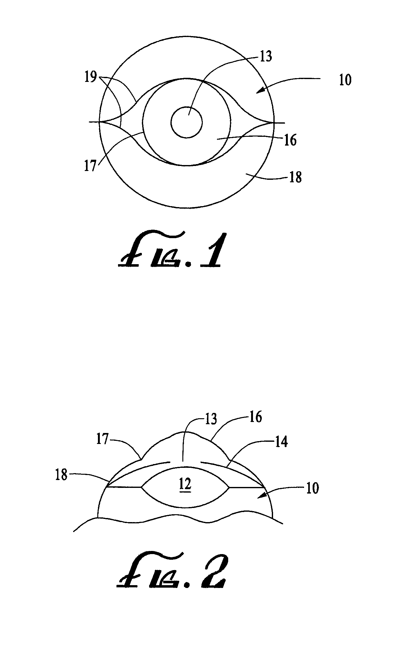 Ring shaped contoured collagen shield for ophthalmic drug delivery