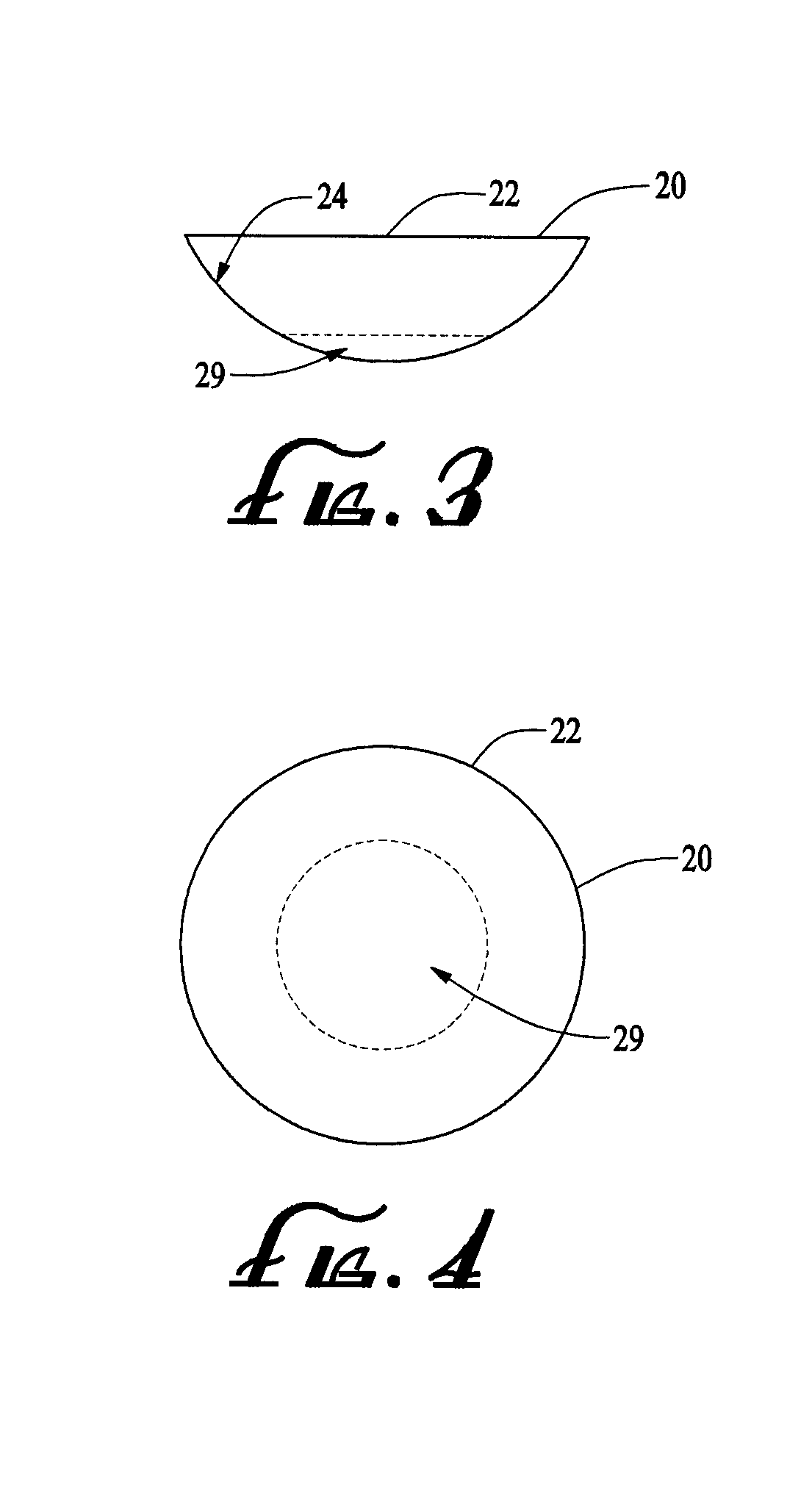 Ring shaped contoured collagen shield for ophthalmic drug delivery