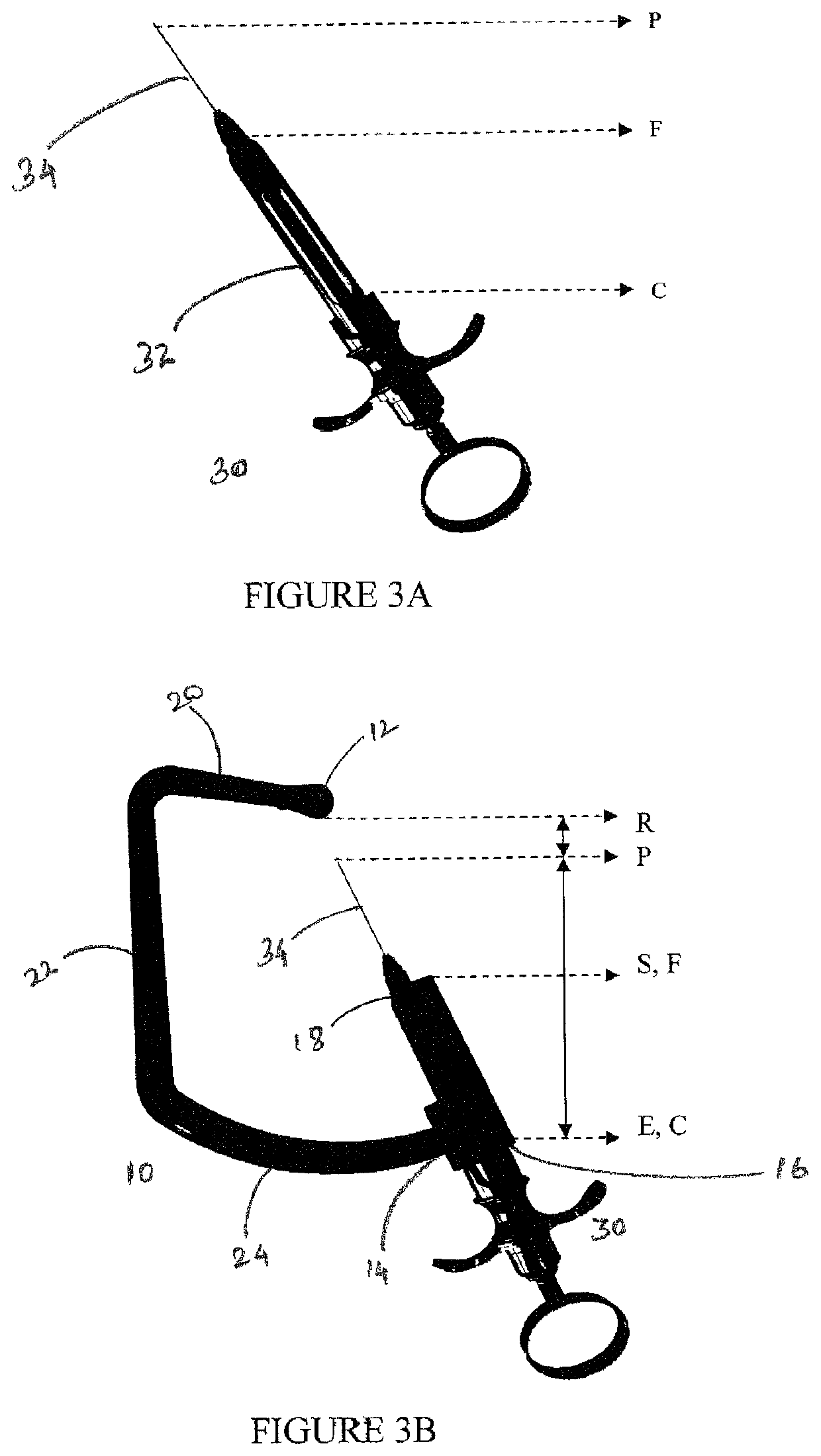 Guiding device for dental anesthesia