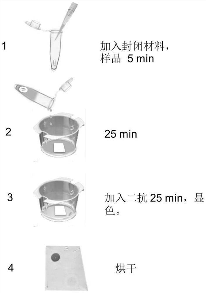 Detection material, preparation method and application of anti-caspr2 autoantibody in human body fluid