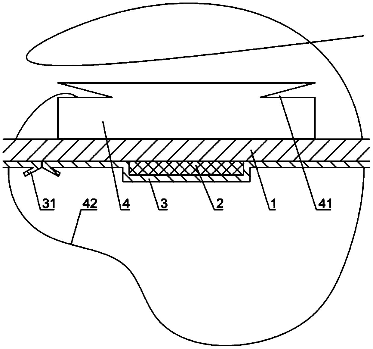 Binding and pressurizing hemostasis transfusion patch