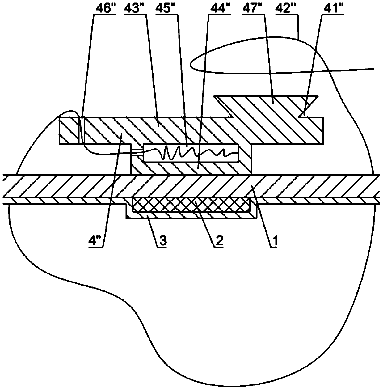 Binding and pressurizing hemostasis transfusion patch