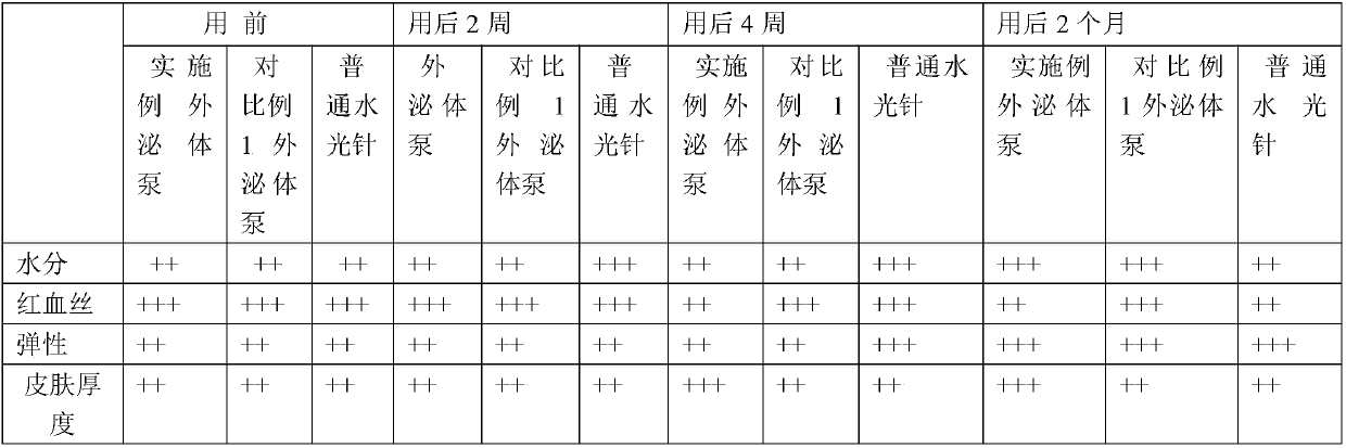 Stem cell exosomes, preparation method and application