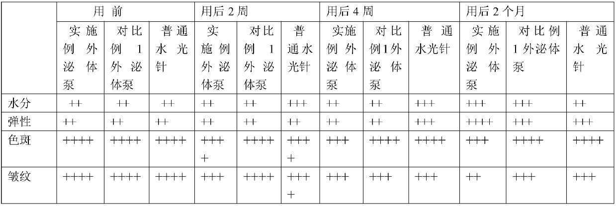 Stem cell exosomes, preparation method and application