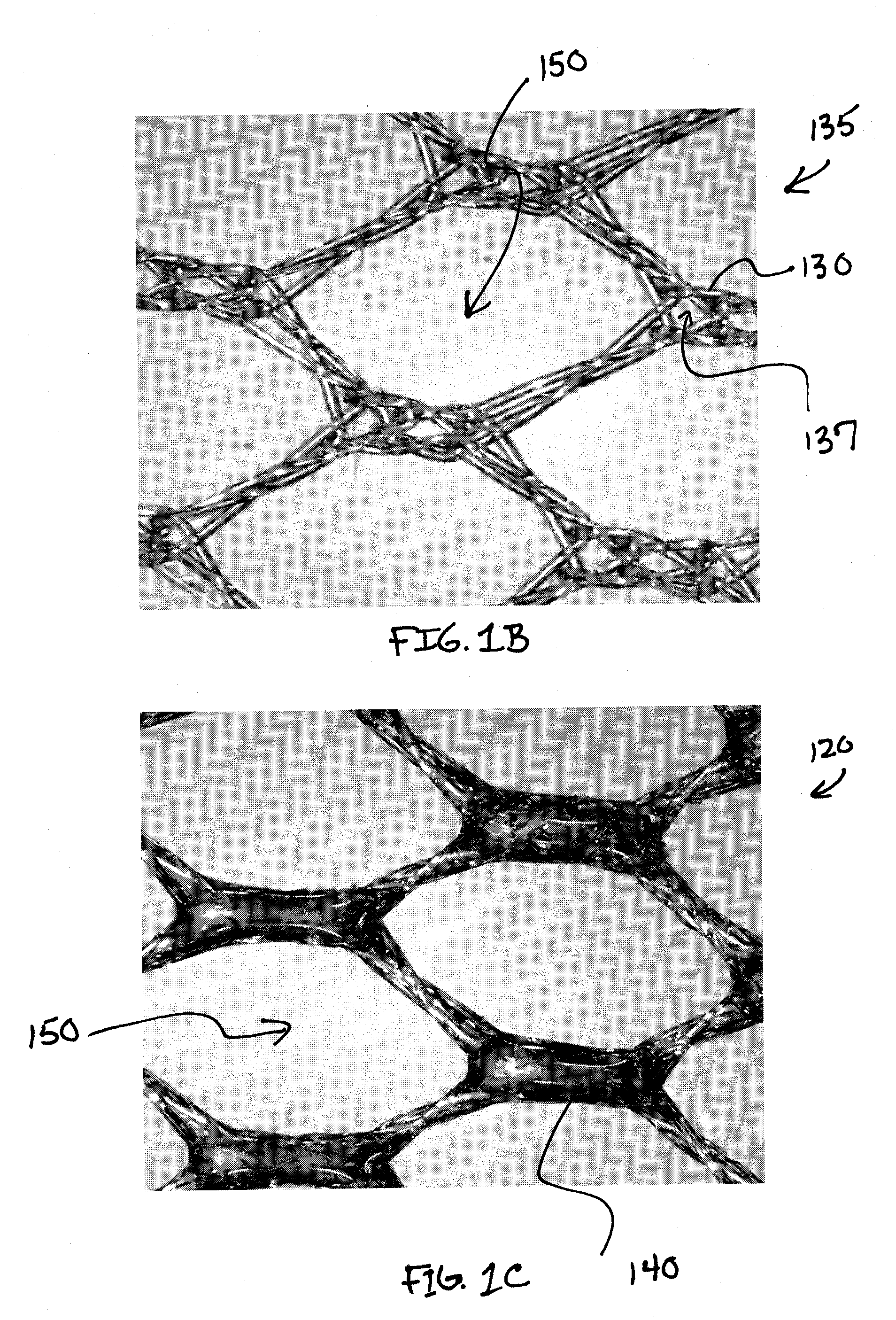 Apparatus and Method for Limiting Surgical Adhesions