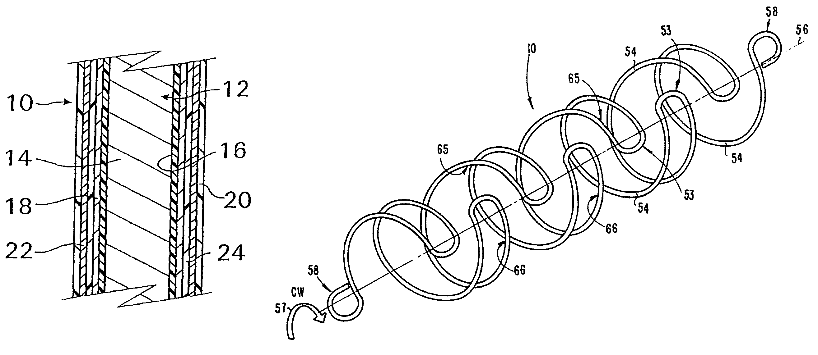 Coated implantable medical device method