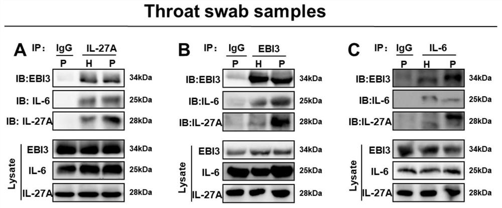 IL-6-IL-27 compound and application thereof in preparation of antiviral drugs