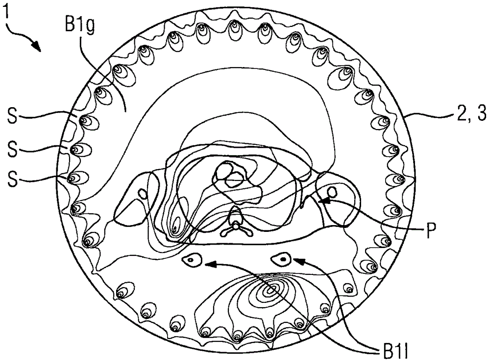 MR Local Coil System, Mr System And Method Of Operation