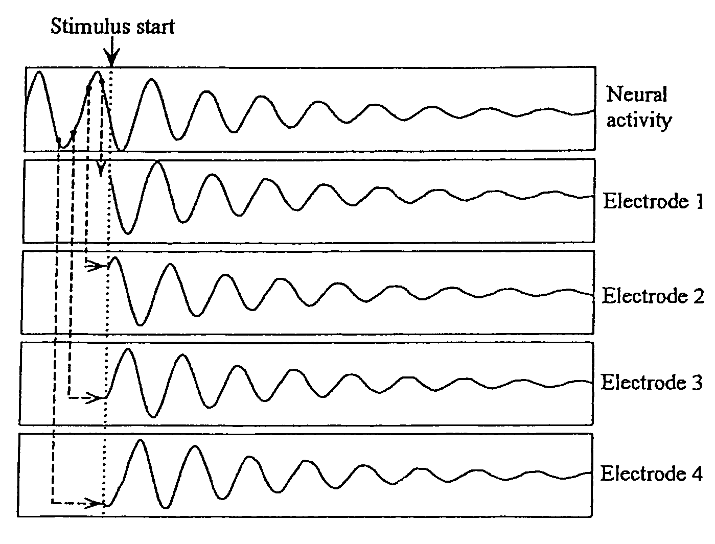 Method and apparatus for desynchronization of neural brain activity