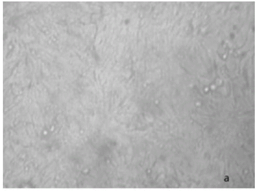 RT-qPCR detection method and primers and TaqMan probe for detecting swine transmissible gastroenteritis virus N gene