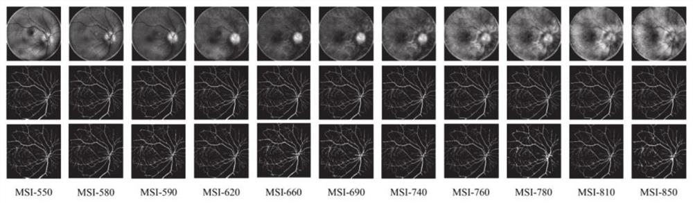 A method and system for multispectral fundus image analysis based on adversarial learning