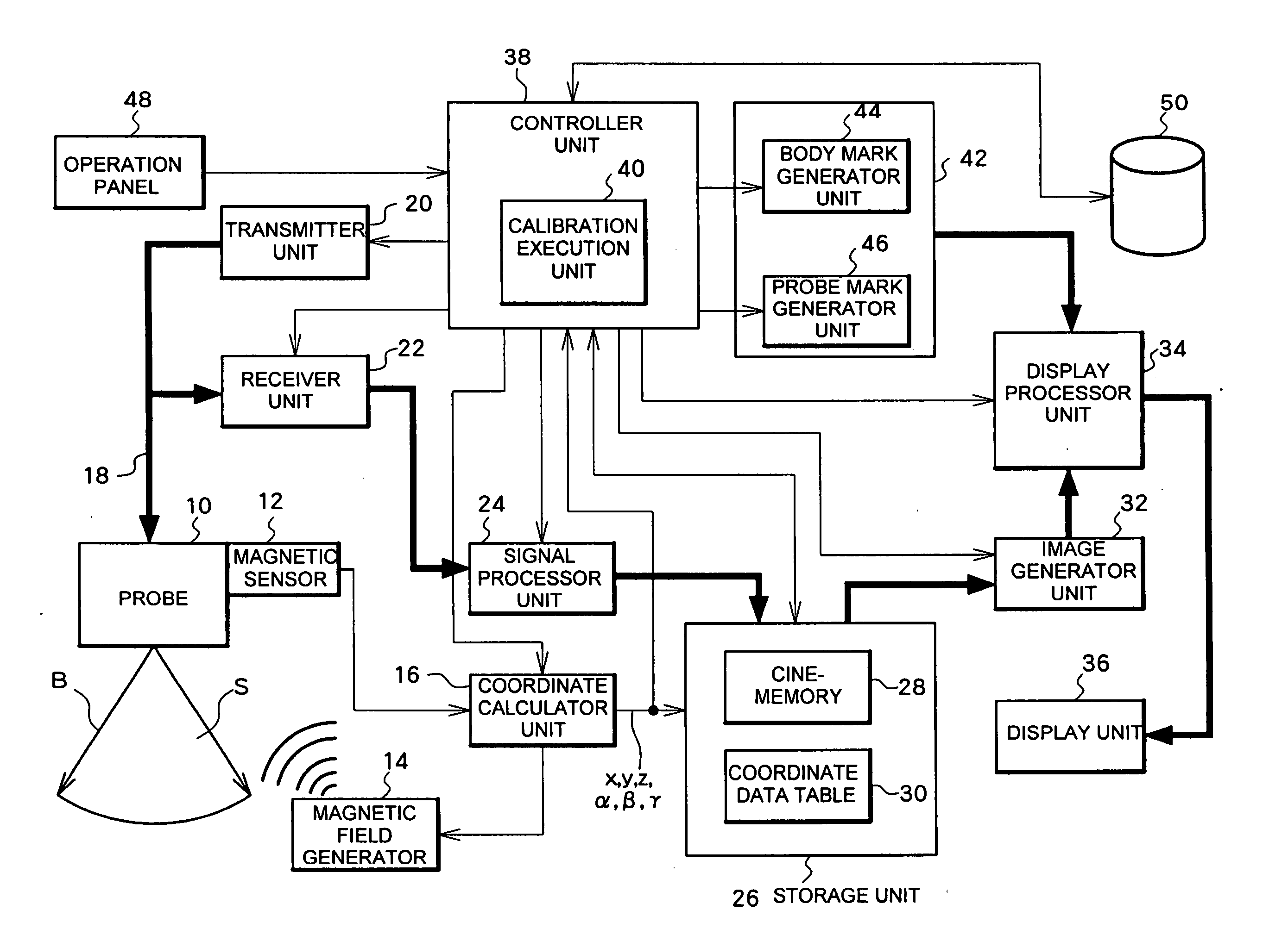 Ultrasound diagnosis apparatus