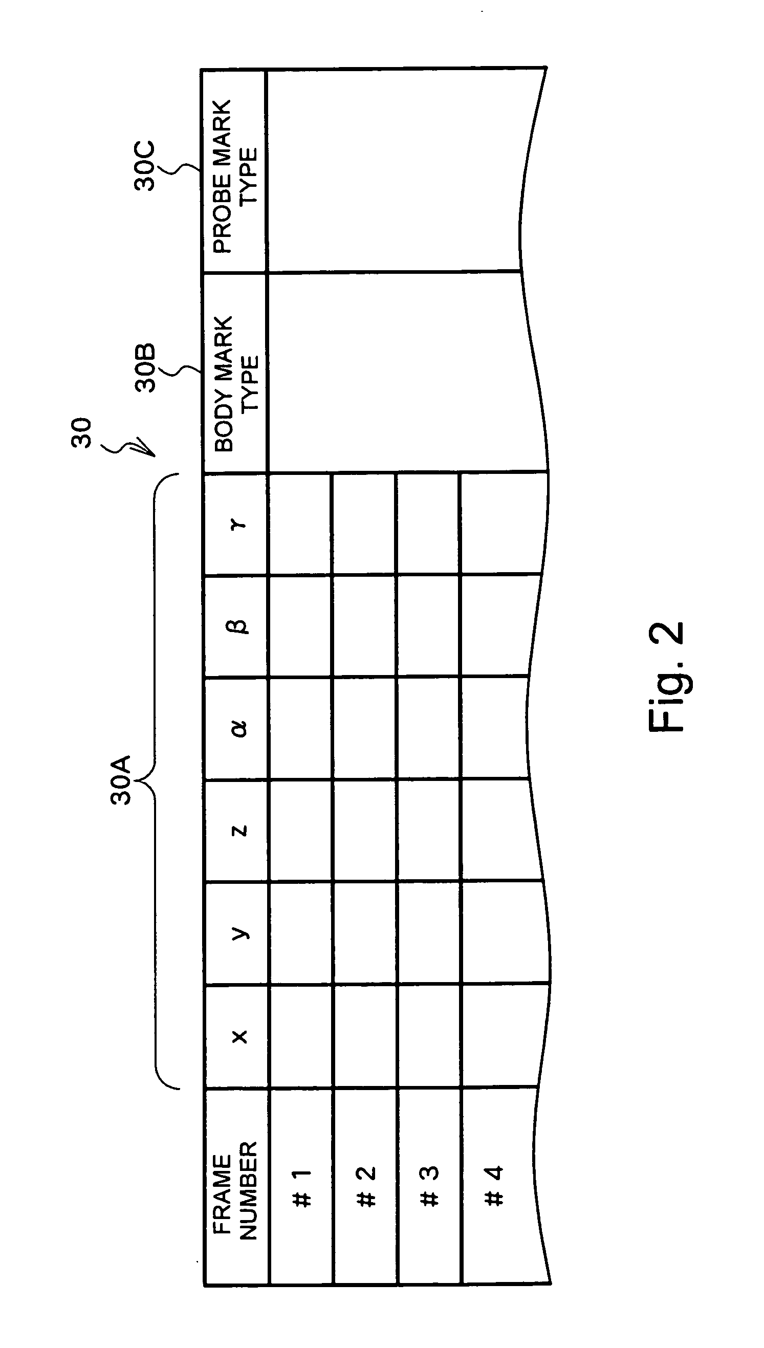 Ultrasound diagnosis apparatus