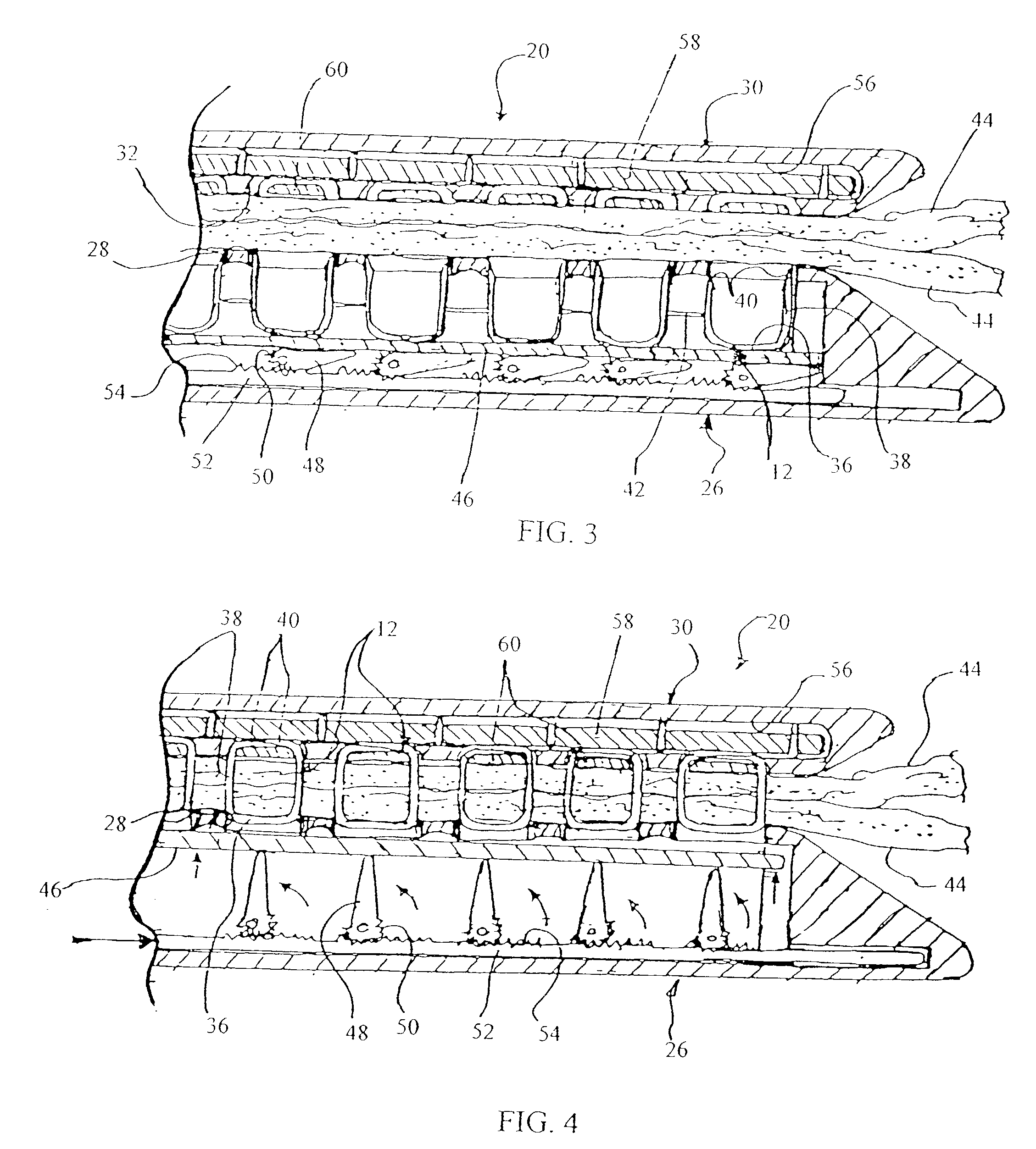 Surgical stapler and method of applying plastic staples to body tissue